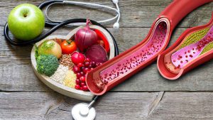 cholesterol-quels-sont-les-aliments-a-eviter